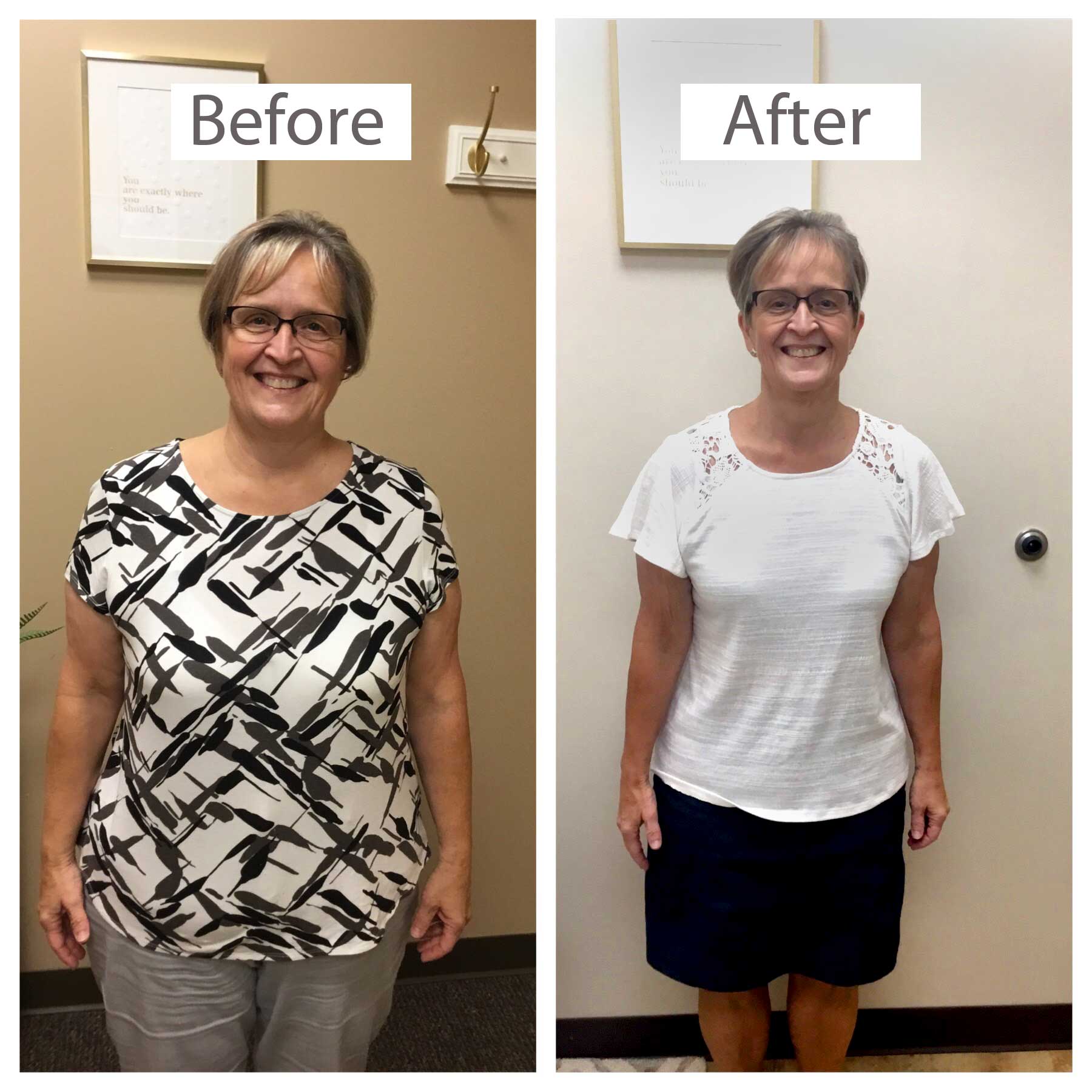 Lori-Before-and-After-Keto-Diet-Weght-Loss