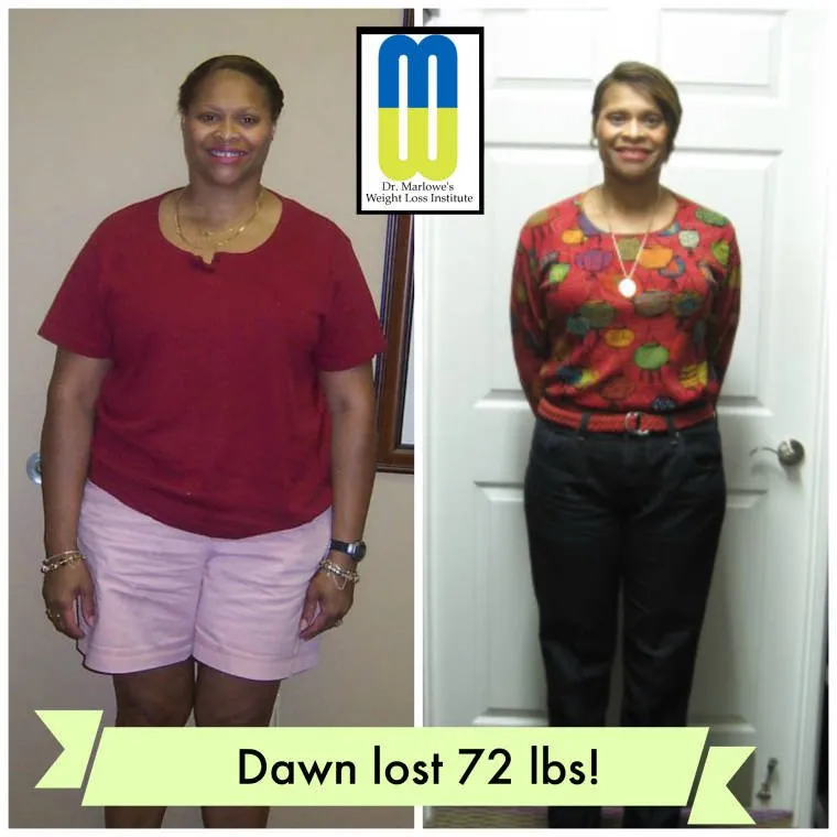 weight-loss-before-after-dawn_zni8ep